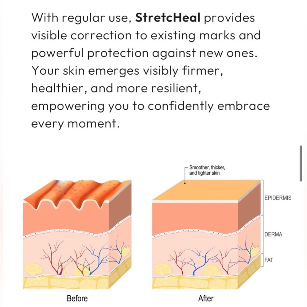 NWT StretcHeal Set Anti Stretch Marks & Scars Cream - Picture 7 of 16